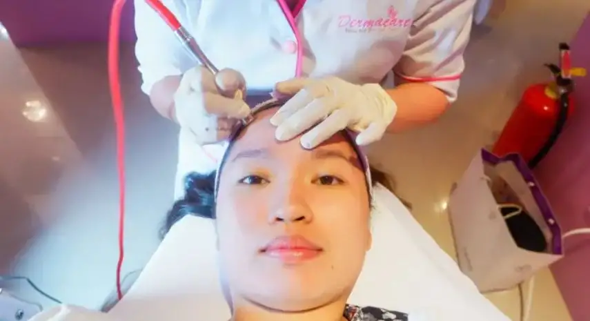 Dermacare Laser & Skin Care Clinics USA Franchise For Sale image 4