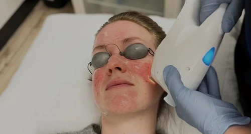 DermaEnvy Skincare Franchise Cost, Fees & Opportunities