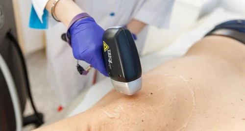 Dermapuritys Franchise Cost, Fees, Opportunity