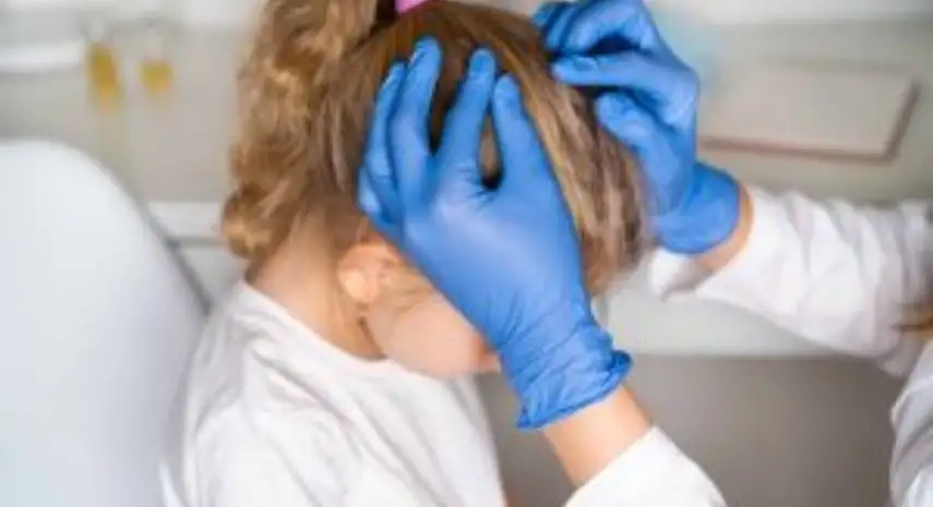 Lice Lifters  - Head Lice Removal