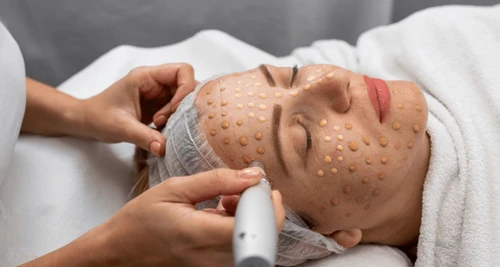 OFY Clinics Franchise Cost, Fees, Opportunity