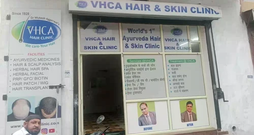 VHCA Hair Clinic Franchise Cost, Fees, Opportunity