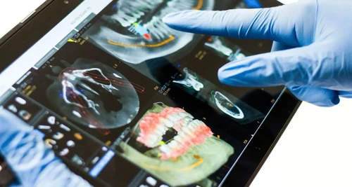 Vi-Scan Diagnostics Franchise For Sale